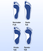 Fußfehlstellungen Fußfehlstellungen